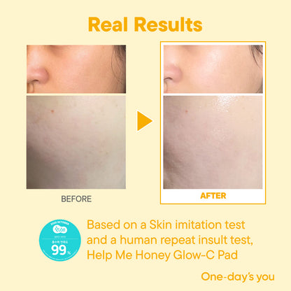 [One-day's you] Honey-C Brightening Pad 60ea