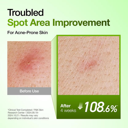 [ANUA] Azelaic Acid 10+ Hyaluron Soothing Serum 30ml
