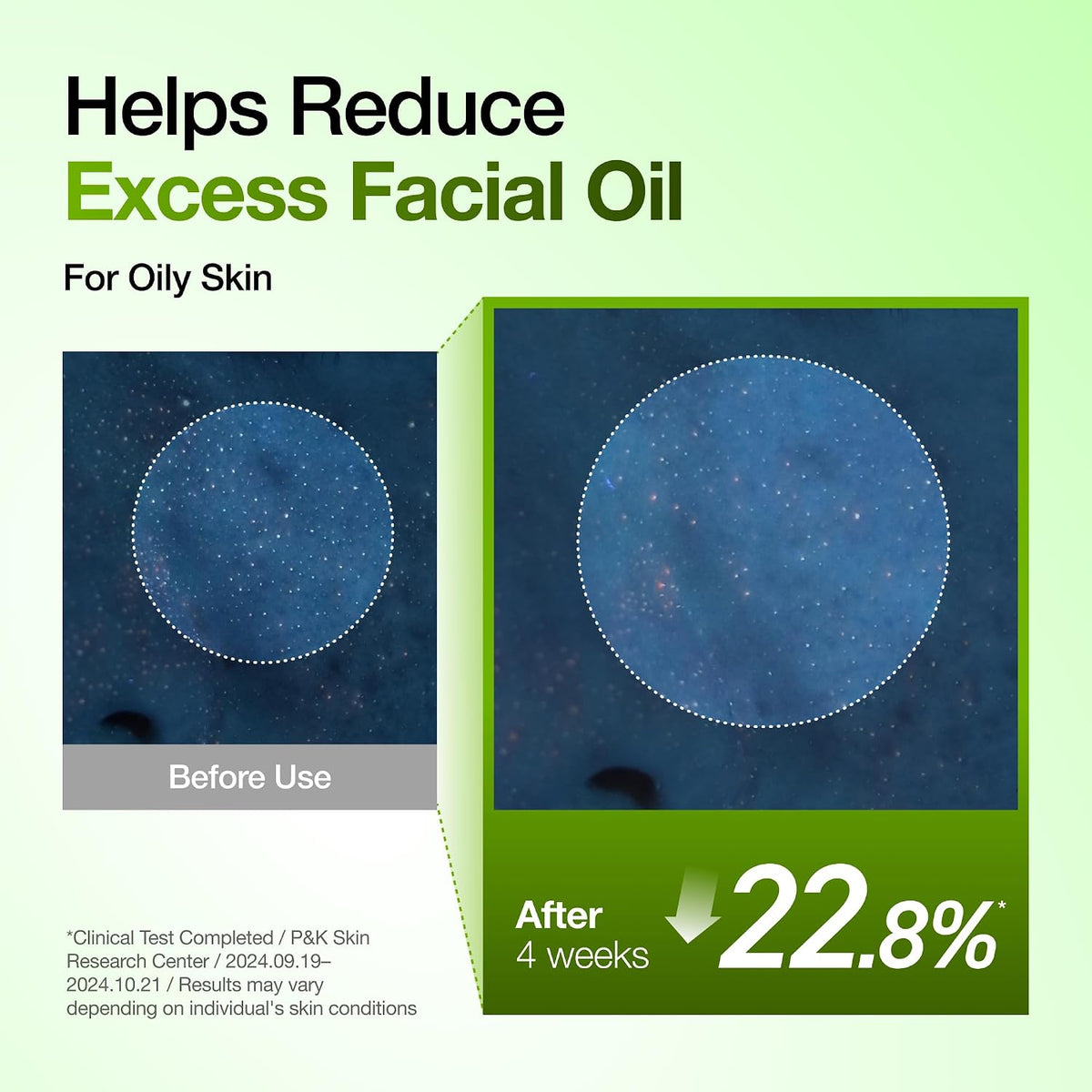 [ANUA] Azelaic Acid 10+ Hyaluron Soothing Serum 30ml