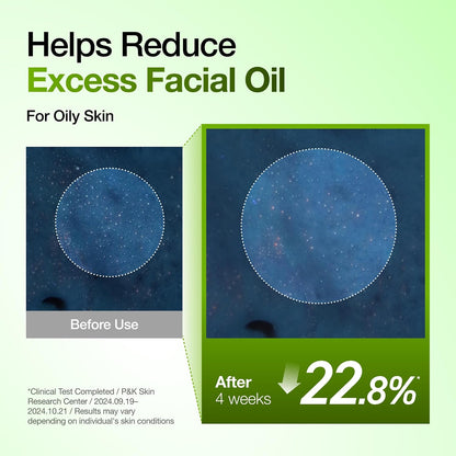 [ANUA] Azelaic Acid 10+ Hyaluron Soothing Serum 30ml