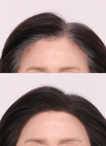 [Lala Chuu] Hair Cushion Master 9g – Hairline & Scalp Cover