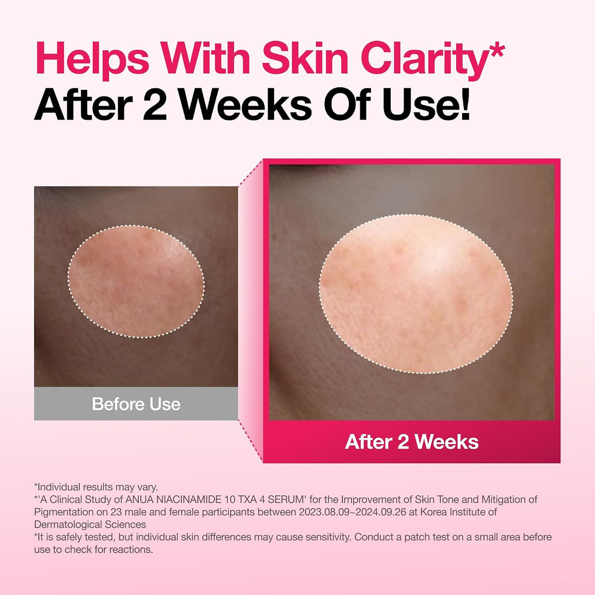 [ANUA] Niacinamide 10% + TXA 4% Dark Spot Renewing Serum 30ml