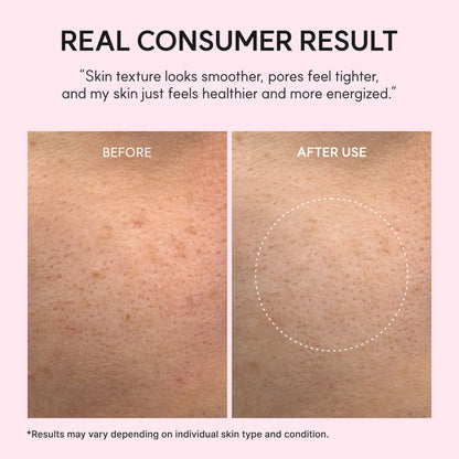 [ARENCIA] PDRN Booster Shot, Rosy-PDRN & Peptides for Glowy, Healthy Skin - Recommended for Sensitive, Red Skin