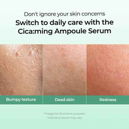[One-day's you] Cicaming Ampoule Serum 30ml