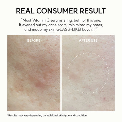 [ARENCIA] Vitamin C Booster Shot, Pure Vitamin C + Glutathione for Bright, Healthy Skin Glow