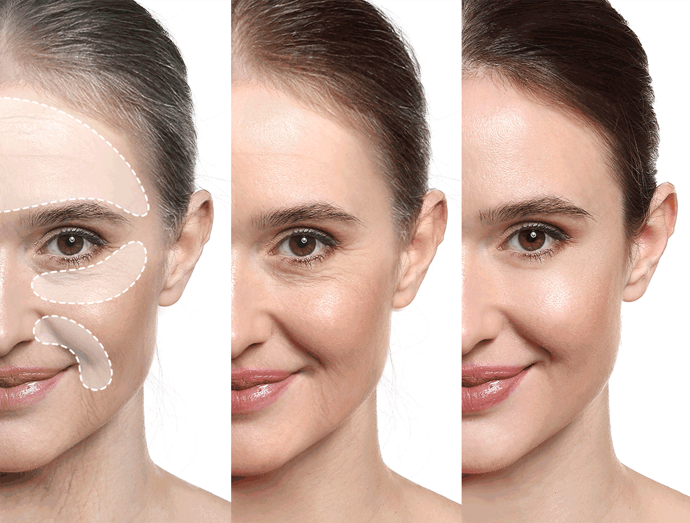 [One-day's you] Real Collagen Pad 70ea