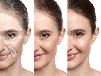 [One-day's you] Real Collagen Pad 70ea