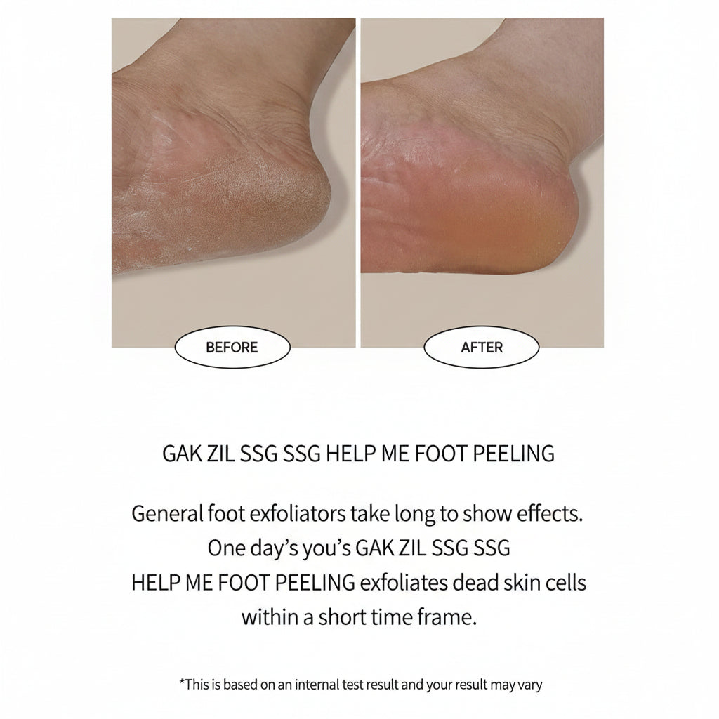 [One-day's you] Gak Zil Ssg Ssg Help Me Foot Peeling 100ml