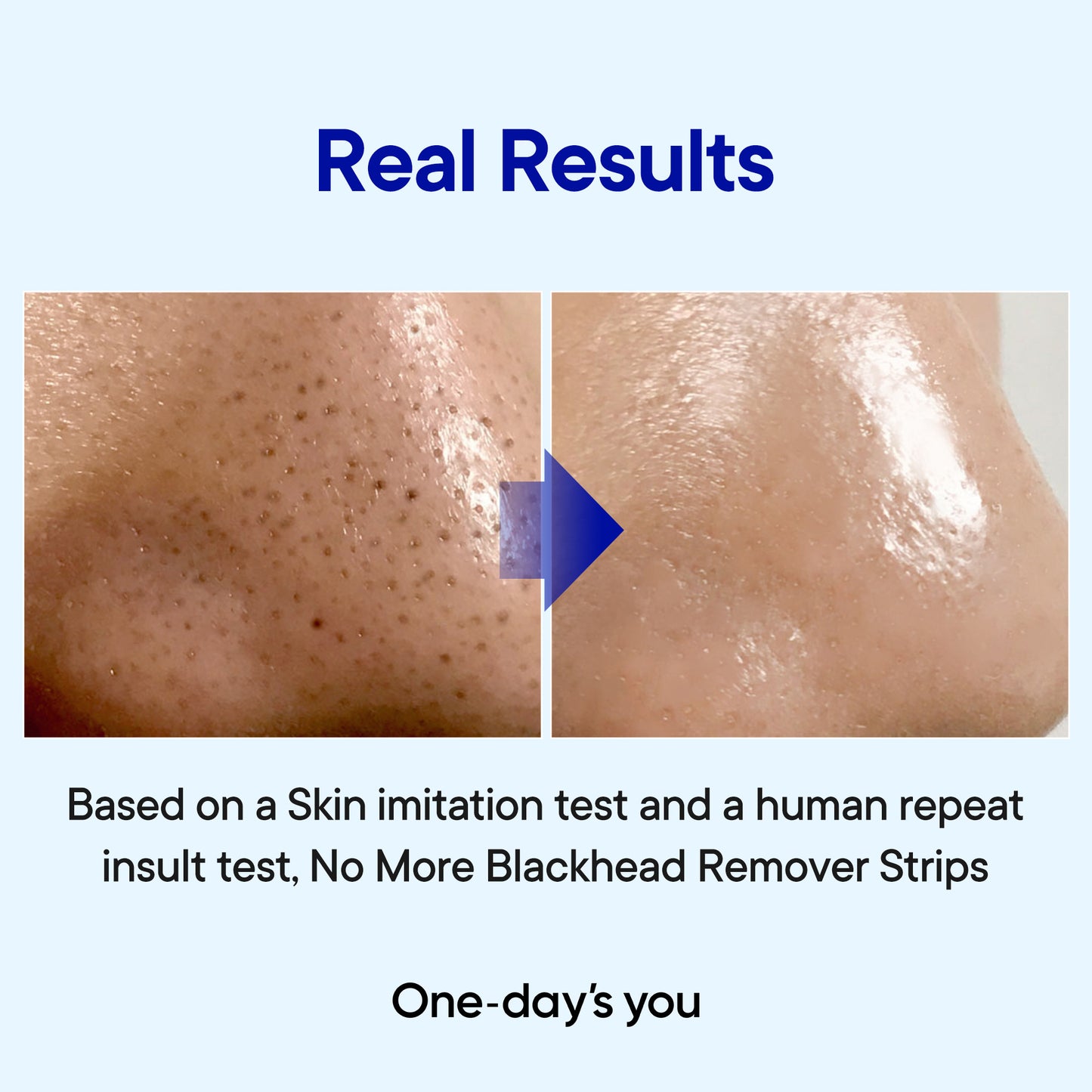 [One-day's you] P.Z. Ssoc Ssoc No More Black Head Duo Set